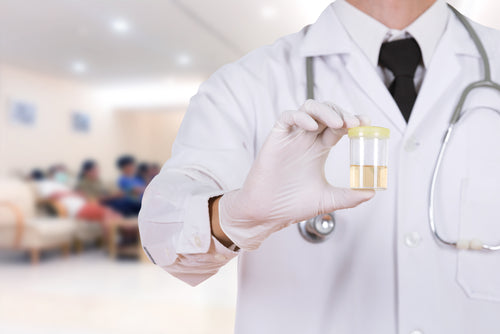 A doctor wearing a white coat and stethoscope holds a small transparent container with a yellow lid in a clinical setting with blurred patients in the background.